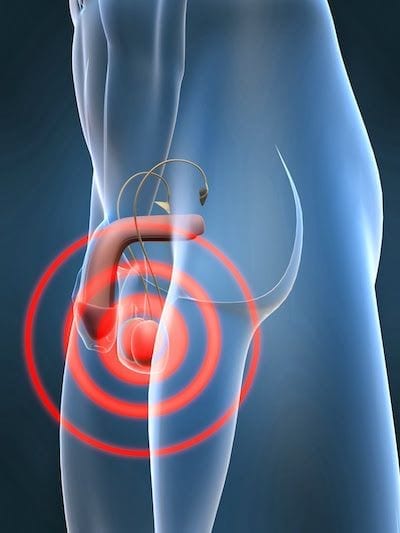 Cirujano Urologo en Mexico Dr Patricio Cruz Especialista en Dolor de Testiculos y Dolor Testicular v001