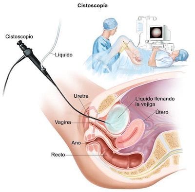 Dr Patricio Cruz Cirujano Urologo especialista en Cistoscopia en Mexico 1.jpg