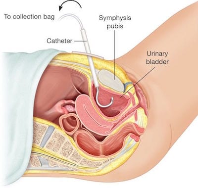 Dr Patricio Cruz Garcia Urologo en Mexico Especialista en Cistostomia