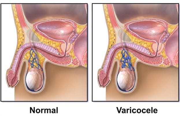 Cirujano-Urologo-en-Mexico-Dr-Patricio-Cruz-Garcia-Especialista-en-Varicocele-002-compressor