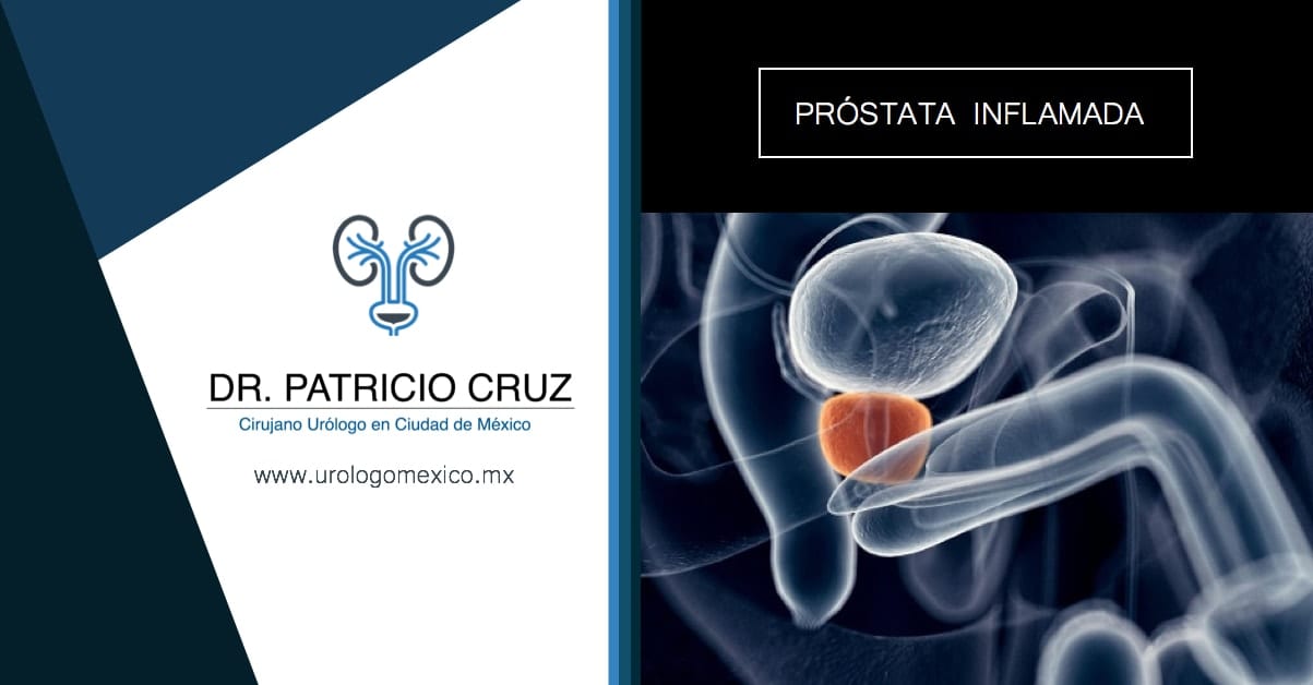 próstata inflamada y dolor anal próstata inflamada y dolor anal