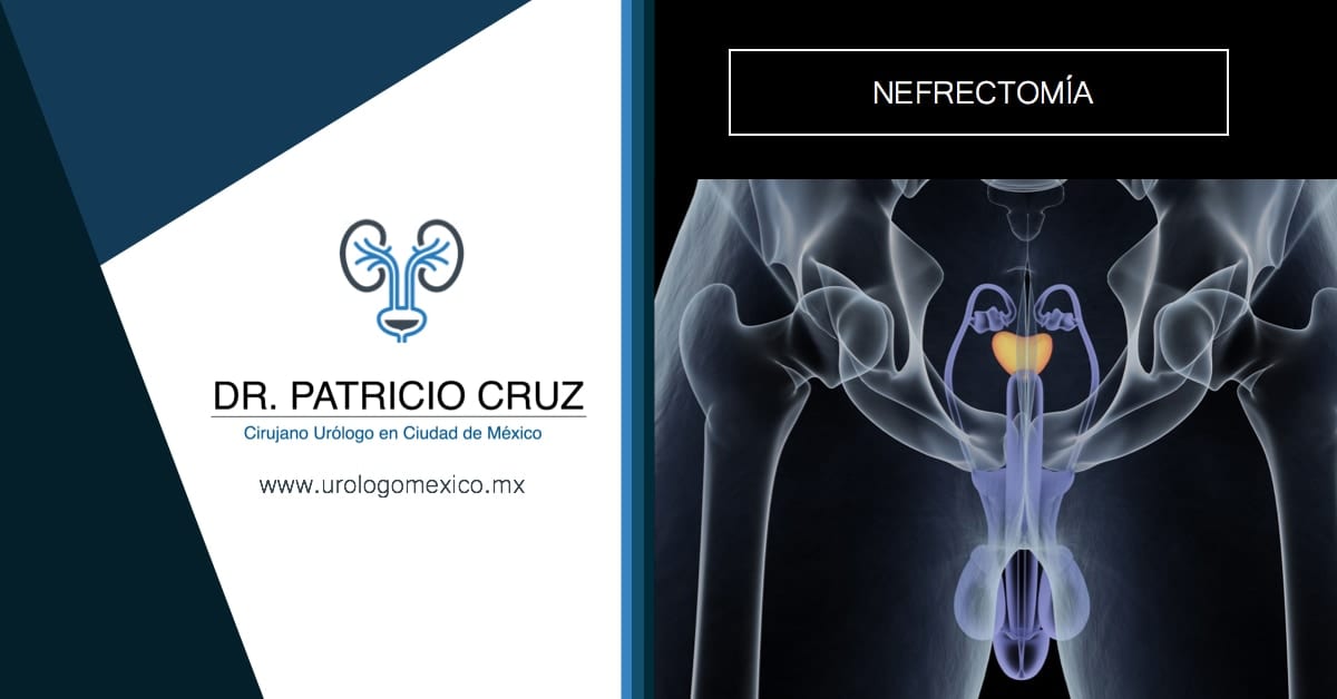 parénquima prostático con inflamación crónicas